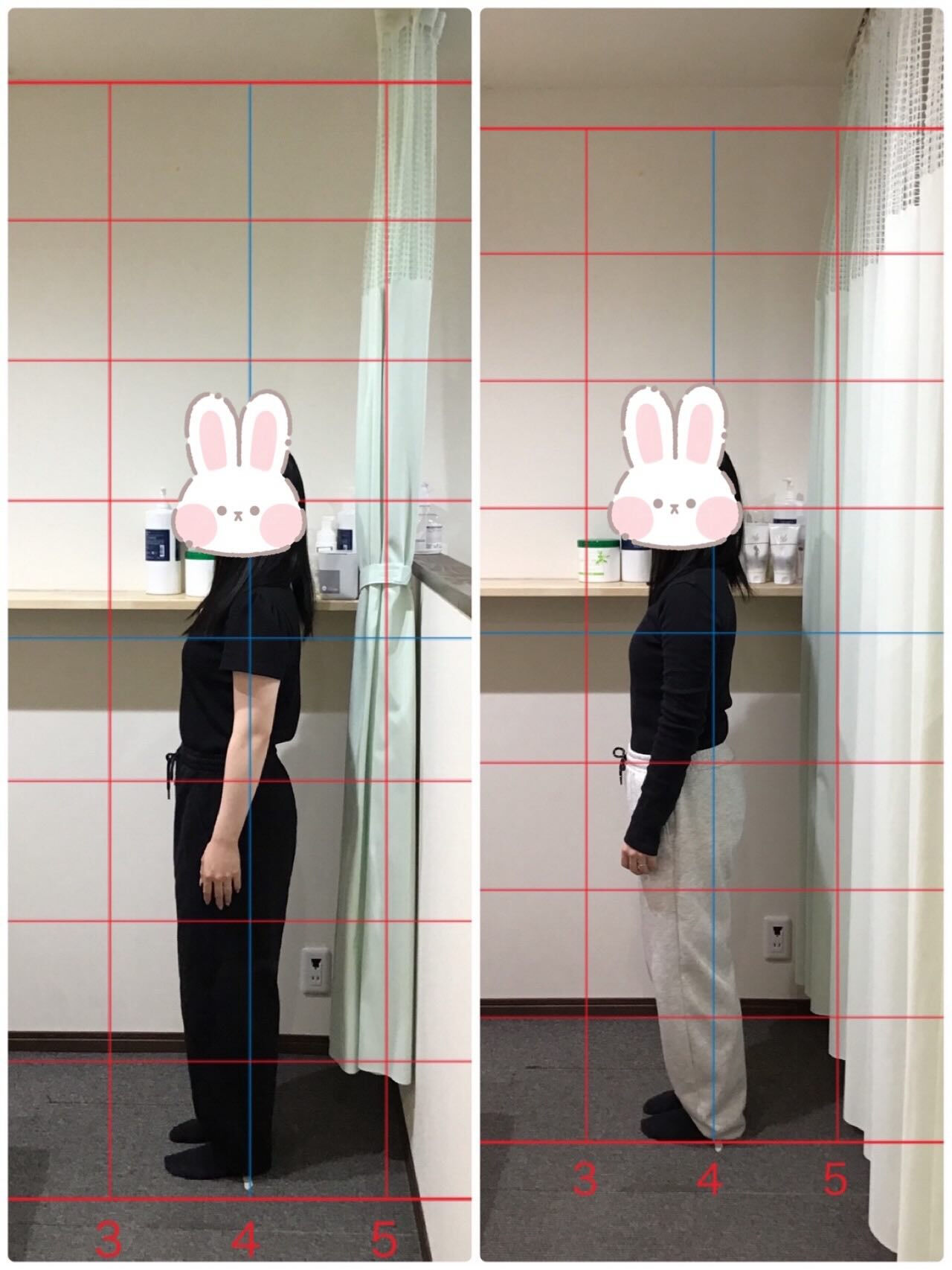 【産後骨盤矯正 Before→After✨】