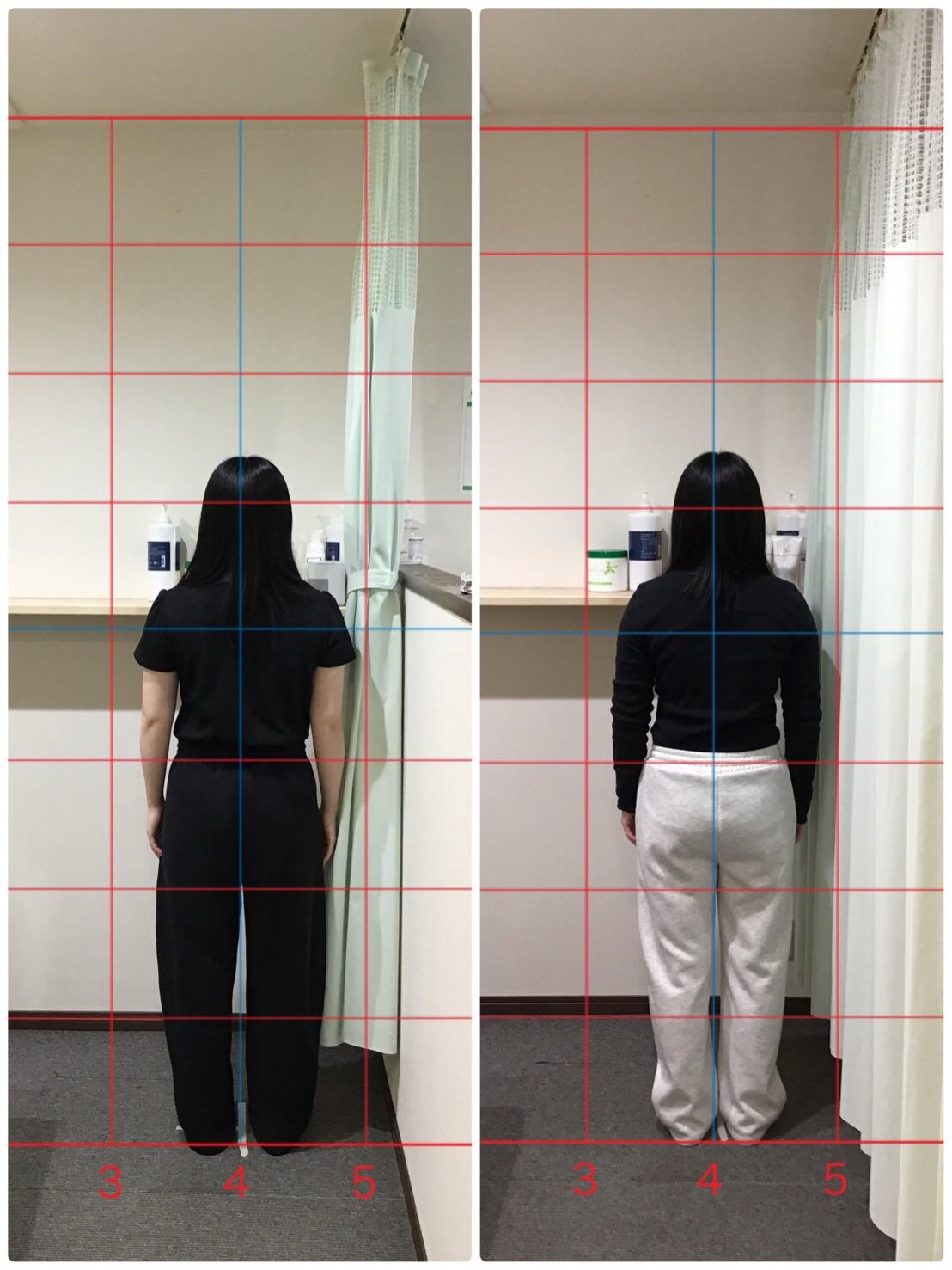 【産後骨盤矯正 Before→After✨】